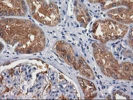 GBA3 / CBG Antibody (clone OTI1F1)