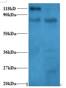 RPL11 / Ribosomal Protein L11 Antibody (Biotin)