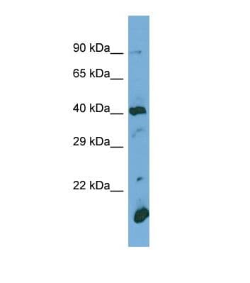 POGLUT1 Antibody (N-Terminus)