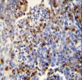 FOSL2 / FRA-2 Antibody (aa95-122)