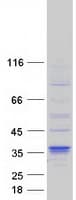 Human DHRS7B Protein (Recombinant Myc-DDK (Flag))