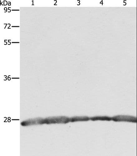 PRDX3 / Peroxiredoxin 3 Antibody