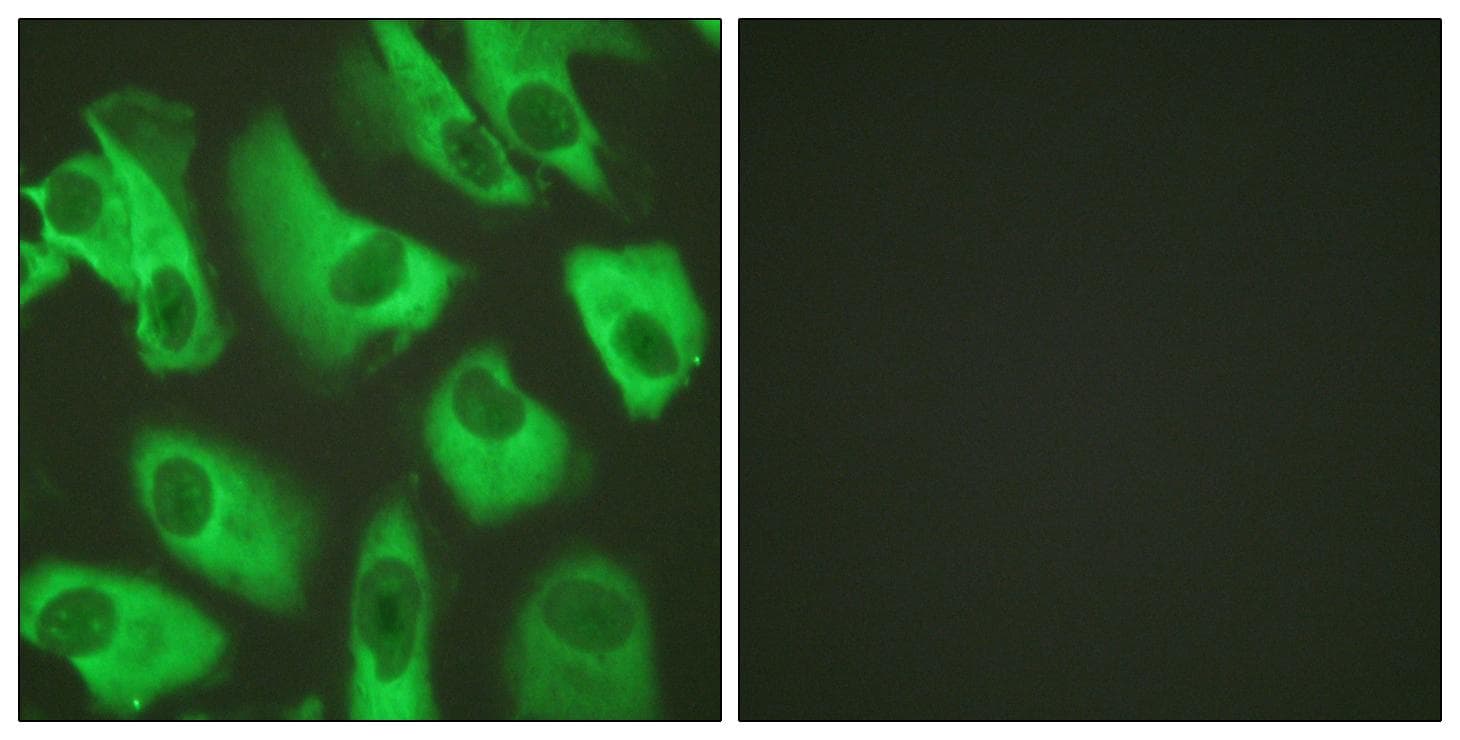 KCNJ16 / Kir5.1 Antibody (p416)