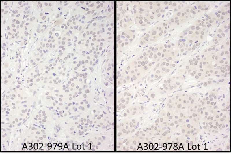 DDX56 Antibody (aa497-547)