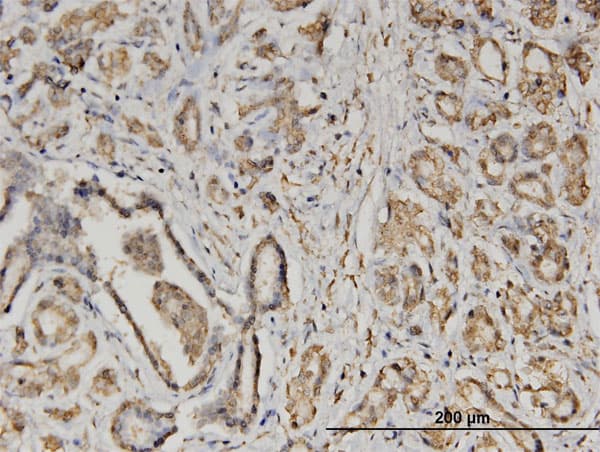Monoclonal Mouse anti-Human EIF2S2 Antibody (clone 2F3, IHC, WB)