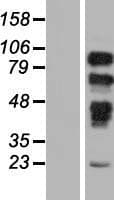 PRPF40B Protein (Over-Expression Lysate Myc-DDK (Flag))