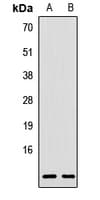 Polyclonal Rabbit anti-Human RPL38 / Ribosomal Protein L38 Antibody (WB)