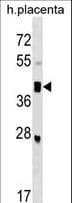 SMOC2 Antibody (aa405-431)