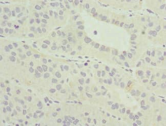 Polyclonal Rabbit anti-Human MLLT3 / AF9 Antibody (IHC)