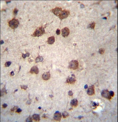 Polyclonal Rabbit anti-Human PHAX Antibody (aa297-326, IHC, WB)