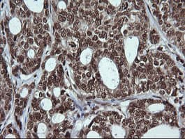 LMO2 Antibody (clone OTI1G10)