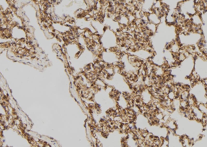DVL2 / Dishevelled 2 Antibody