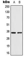 AKR1E2 Antibody (Internal)