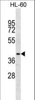 Polyclonal Rabbit anti-Human NR2E1 / TLX Antibody (aa75-102, WB)