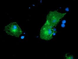 Monoclonal Mouse anti-Human CCK4 / PTK7 Antibody (clone OTI2H4, IF, WB)