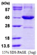 Human SRR / Serine Racemase Protein (Recombinant His)