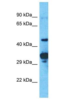 Polyclonal Rabbit anti-Human PRAMEF2 Antibody (aa423-472, WB)