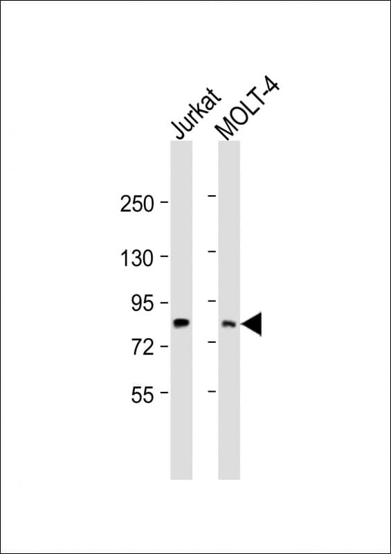 LCP2 / SLP-76 Antibody (Internal)