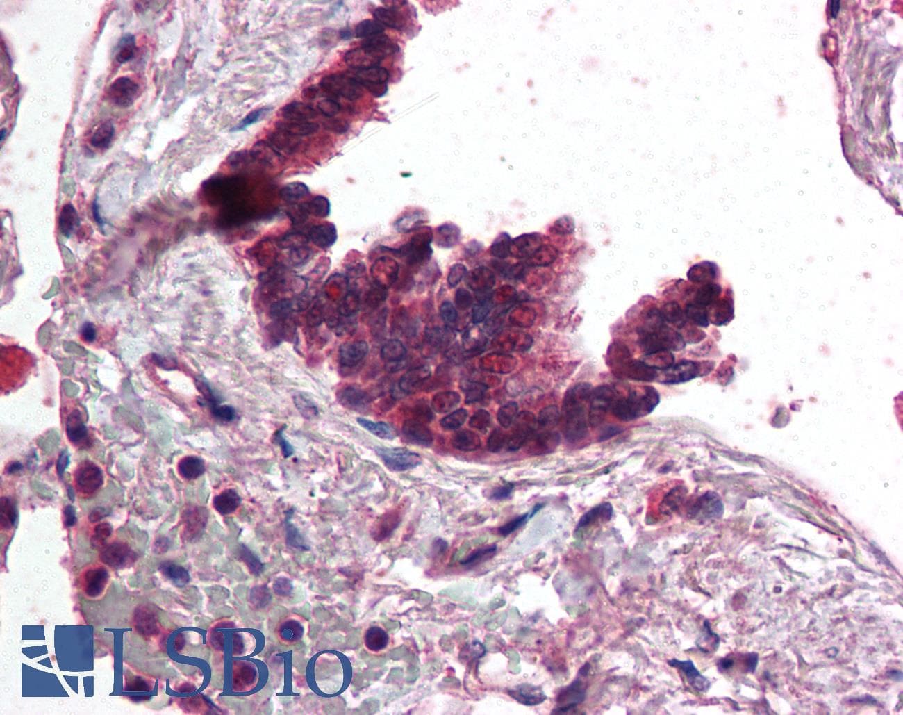 IHC-plus™ AP3D1 / Adaptin Delta Antibody (aa675-700)