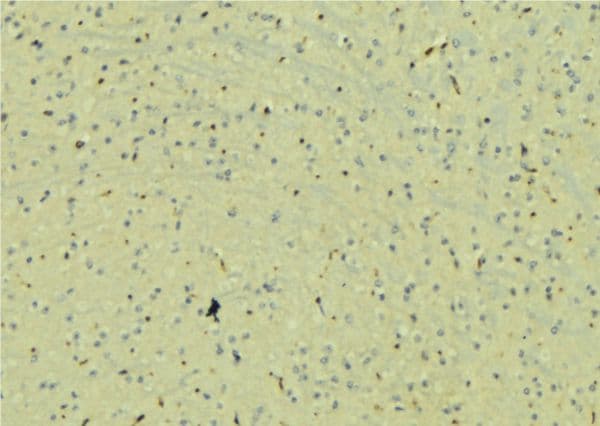 NAG20 / UBAP1 Antibody