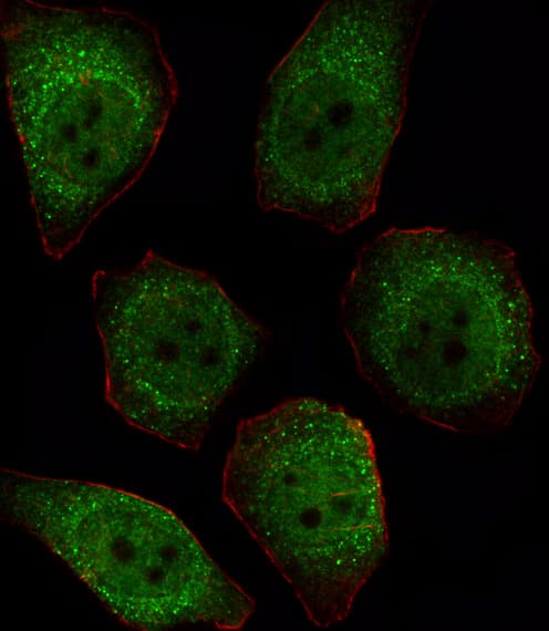 PPP1CB Antibody (aa286-315)