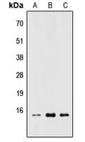 RPL22 / Ribosomal Protein L22 Antibody (Internal)
