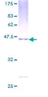Human PMCH / MCH Protein (Recombinant GST)