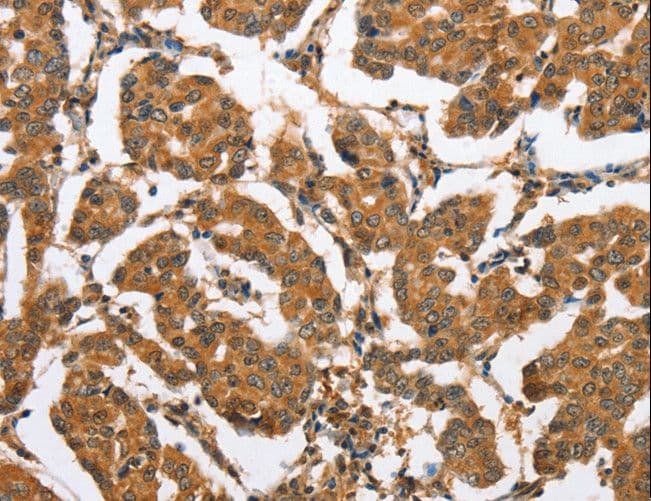 BRAK / CXCL14 Antibody