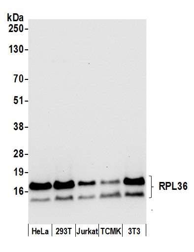 RPL36 / Ribosomal Protein L36 Antibody (aa1-50)