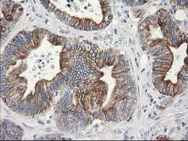 OSGEP Antibody (clone OTI8B3)