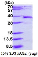 Human DERA Protein (Recombinant His)