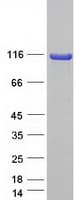 Human SCYL1 / NTKL Protein (Recombinant Myc-DDK (Flag))