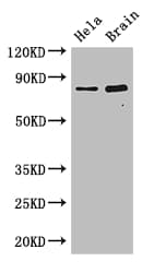 Polyclonal Rabbit anti-Human ING3 Antibody (IHC, WB)