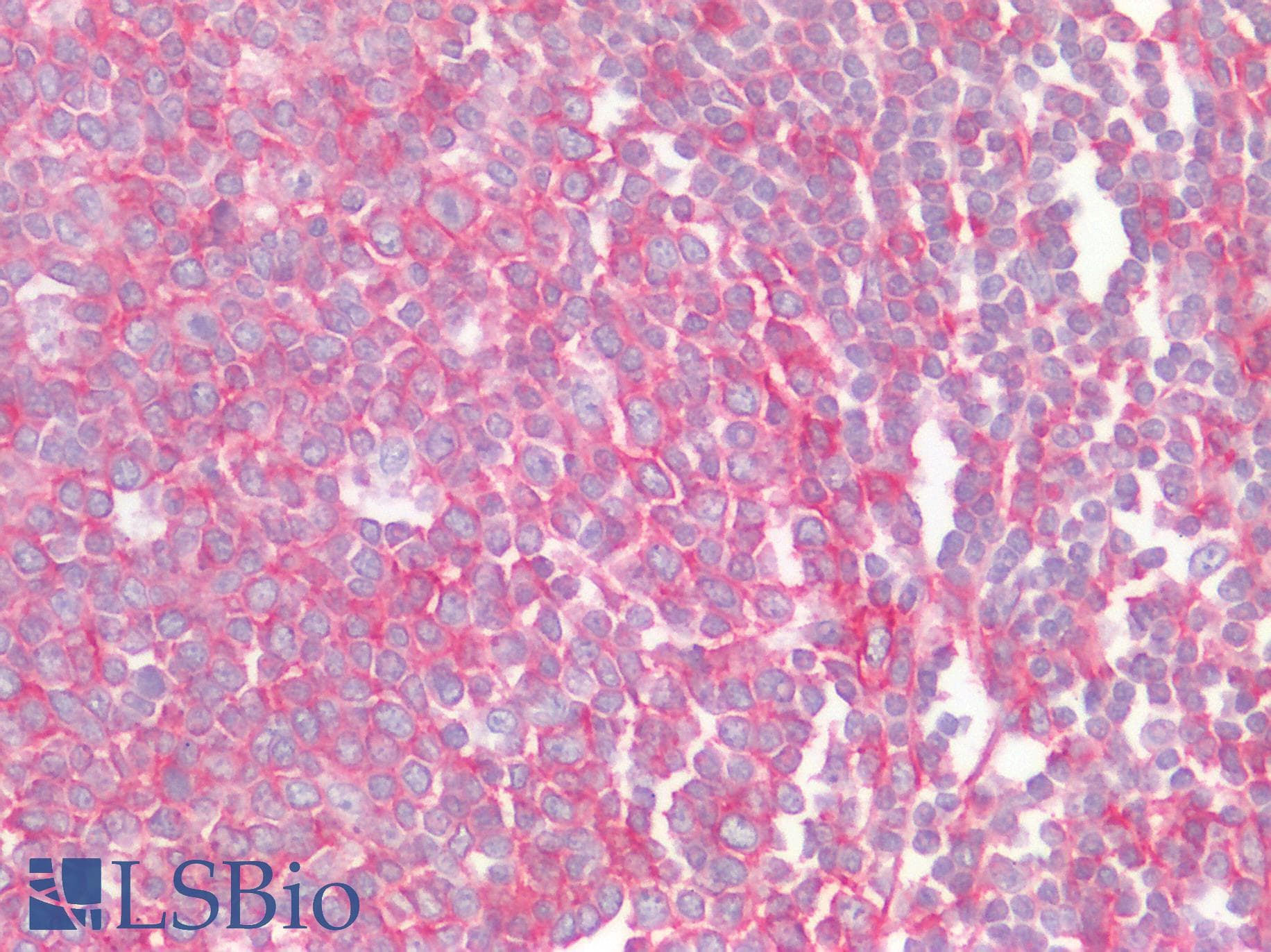 IHC-plus™ CCR6 Antibody (Extracellular Domain)