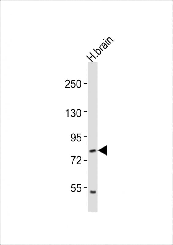 IHC-plus™ Polyclonal Rabbit anti-Human RFX4 Antibody (aa684-720, IHC, WB)