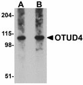 IHC-plus™ Polyclonal Rabbit anti-Human OTUD4 Antibody (IHC, IF, WB)