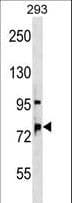 OSBPL11 Antibody (aa76-102)