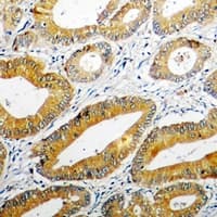 Polyclonal Rabbit anti-Human PPOX Antibody (IHC, IF, WB)