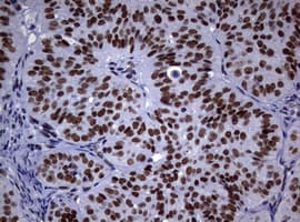 NBN / Nibrin Antibody (clone OTI7D5)