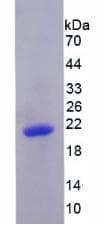 Human BLIMP1 / PRDM1 Protein (Recombinant His, N-Terminal)