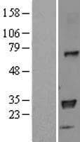 HLA-DPB1 Protein (Over-Expression Lysate Myc-DDK (Flag))