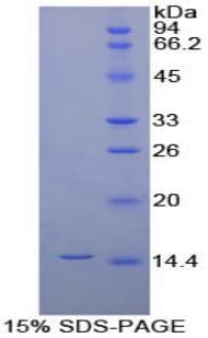 Dog IL8 / Interleukin 8 Protein (Recombinant His-S)