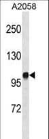 DGK-IOTA / DGKI Antibody (aa890-920)