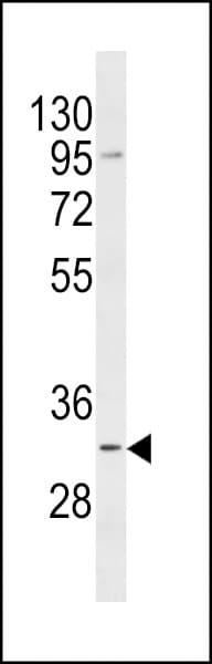 CCDC44 / TACO1 Antibody (aa50-77)