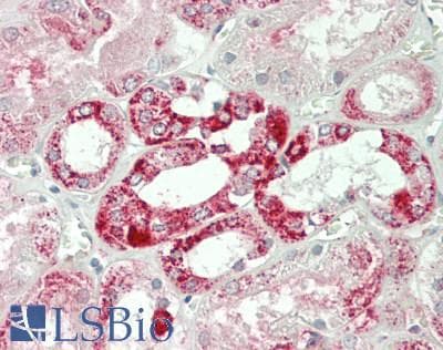 GOT2 Antibody (aa30-430)
