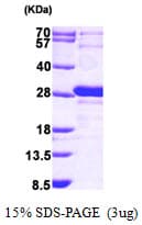 Human GRPEL1 Protein (Recombinant His)