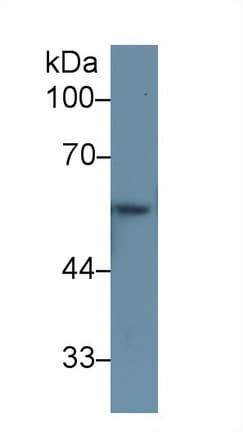 KRT6A / CK6A / Cytokeratin 6A Antibody (aa163-468, Biotin)