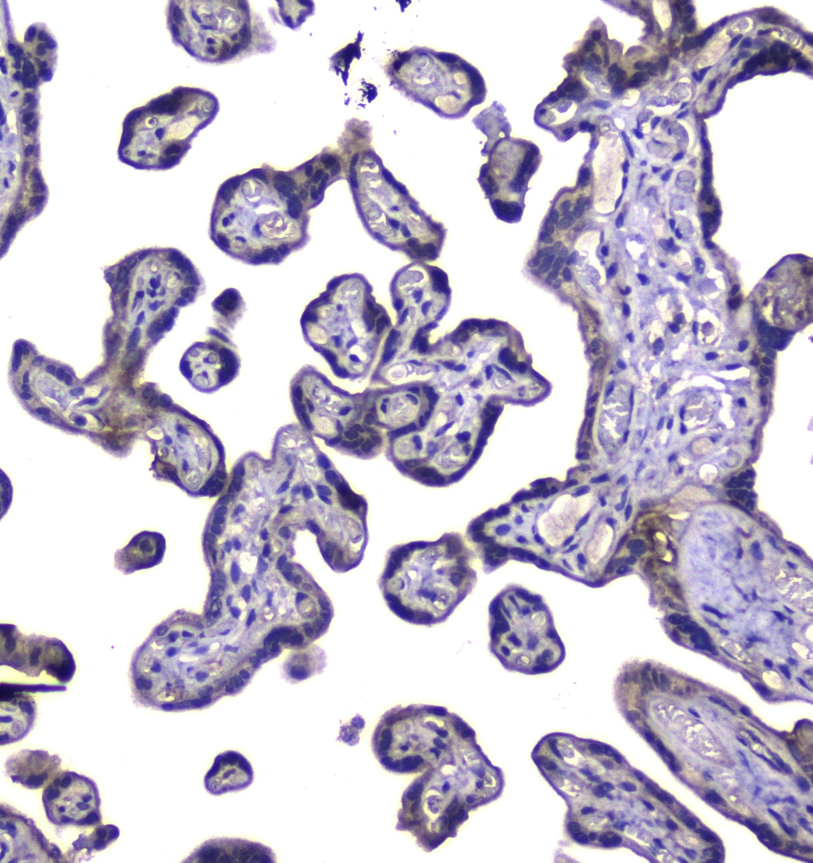 RAB6A / RAB6 Antibody