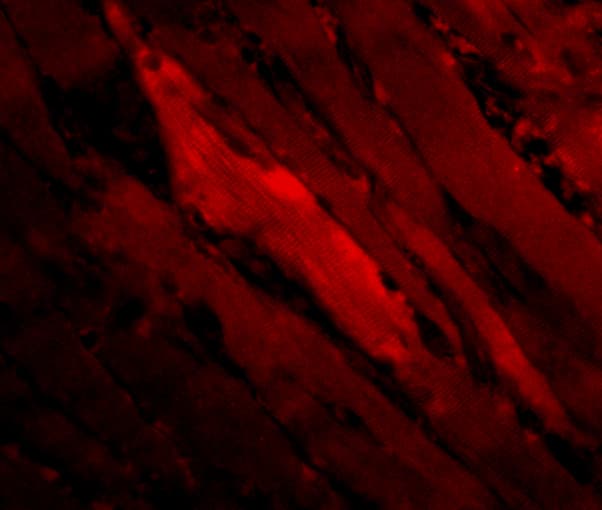 IHC-plus™ PTPN11 / SHP-2 / NS1 Antibody