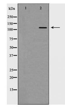 GRM5 / MGLUR5 Antibody